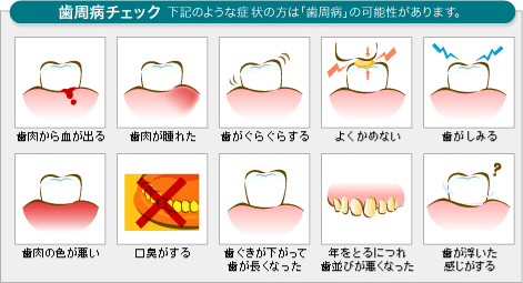 診療内容 柏市で歯周病治療なら とみせ歯科室